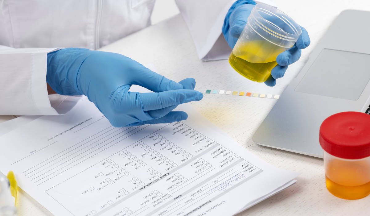 Exame Toxicológico para CNH R$ 99,00